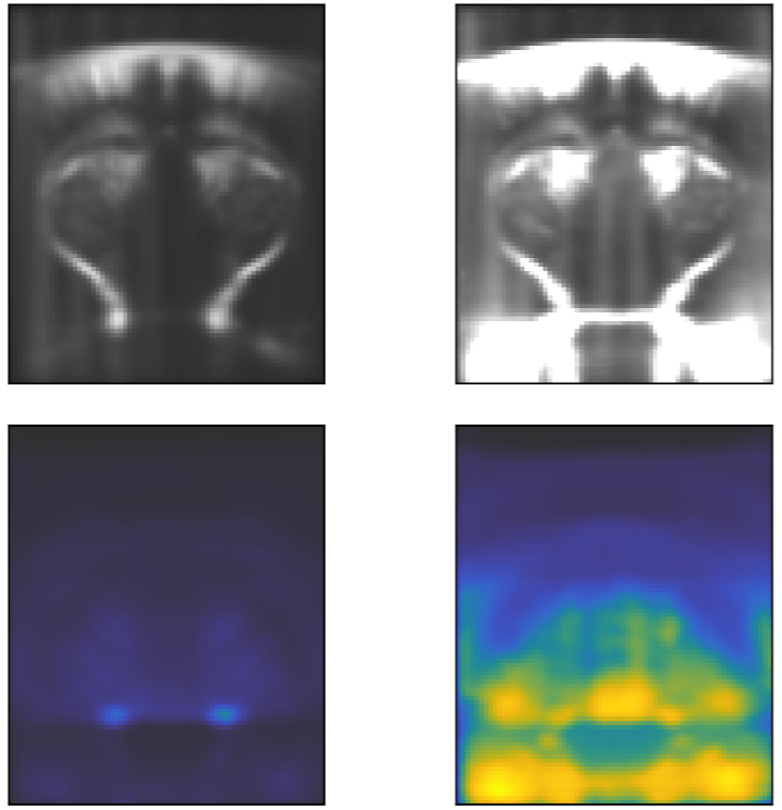 fUSI images before and after motion artifact removal